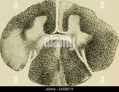 Un traité sur les maladies nerveuses des enfants, pour les médecins et les étudiants . lorsqu'il est coupé des théircellules d'origine, tout comme les fibres blanches dans d'autres parties du système de vous en souffrent. Une avancée considérable dans l'étude ofrachidienne - les faisceaux de cordon a été effectuée par la découverte de Flechsigs que les fibres de thénérave de différents tractsacquièrent leur chéathsat médullaire différentes périodes de développement. Les fibres dont la gaine médullaryest développée à environ la période de temps évidentlyappartiennent ensemble et sont des parties du système. Aux méthodes de Tiirck et de Flechsig, nous pouvons ajouter la méthode de l'atrophie c. Gudden, W Banque D'Images
