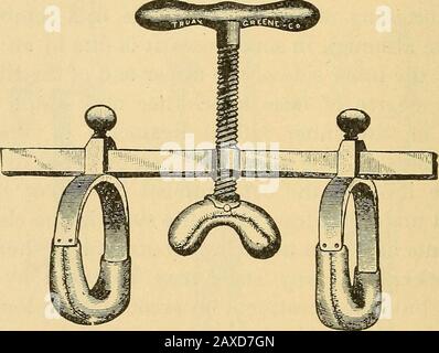 Conférences sur la chirurgie orthopédique . g bya renforcement conduit à l'allongement de l'ensemble du membre, qui peut s'avérer aussi grand un handicap que le genou-knock. La condition de Sucha doit être soumise à l'opération d'Ogstons, qui doit être décrite ci-après. C'est la coutume de beaucoup de chirurgiens et de tous les fabricants d'instruments qui sont appelés à traiter les cas de kneekneekneeto appliquer les étrésillons classiques déjà décrits, avec l'ajout d'un grand coussin sur le côté du condyle intérieur 268. Ce traitement pour la correction de la déformalité est absolument inutile. Le secret du succès dans le traitement de l'étrésillon du genou-knocké est en ke Banque D'Images