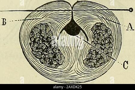 Manuel de médecine générale . Fig. 617. Deuxième génération de Nélaton. Opération ne furent pas de lune heurees,que celles de|la première. ÉPISPADIAS. 515 ^ Dolbeau une société trois fois, dont deux avec sucès, lopérationde lépispadias par le deuxième procudé de Nélaton. Procédé de Tliiersch. — Lopération basée sur le principe de. Banque D'Images