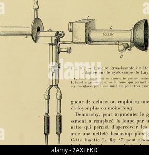 Traitâe pratique de cystoscopie et de cathâetâerisme . 87. — Lunette grossissante de Demonchyadaptée sur le cystoscope de Luys. R. boite carrée où se trouve le prisme redresseur. —I.. Lunette grossissante. — B, ro |ui permet de détente localaire pour une mise au point lii-s exacte. Giteur de celui-ci sur emploiera unc loupede foyer plus ou moins long. Demonchy, pour augmenter le grossis-ment, a remplacé la loupe par une lu-nette qui permet dapierceevoir les objetsavec une netté beaucoup plus grande.celle lunette (L, fig. 87) peut sadapler àla place de la lampe sur la tige du manch Banque D'Images