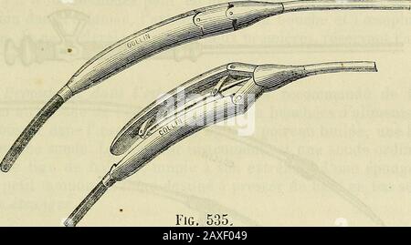 Manuel de médecine générale . Dilatator œsophagiea de Léon le fort. Né à faciliter son introduction. Jai dû plusieurs fois, pendentif unedurée de trois ans, pratiquer la dilatation jjrusque qui amenait Banque D'Images
