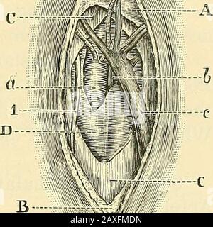 Un manuel de chirurgie opératoire . chap, iv] LIGATURE DU FÉMORAL SUPERFICIEL 415 , B. Sa frontière intérieure devrait être bien isolée, et la muscleis entière est ensuite dessinée vers l'extérieur. L'opérateur se sent maintenant pour la rainure de l'artère. L'avant du vaisseau se trouve des branches du nerf cube interne, et plus profonde et à son côté extérieur sont le nerf saphène long, et peut-être le thenerve à l'intérieur de l'immensité (Fig. 341). La gaine du récipient a bien ouvert et l'aiguille passe-passe du côté intérieur. Commentaire. — le triangle Scarpas est beaucoup plus petit que ce qui semble être le cas lorsque la disse Banque D'Images