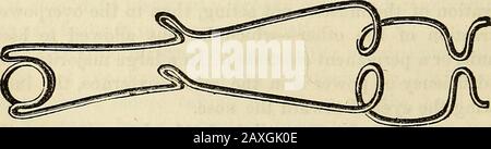 Conférences sur le système américain éclectique de chirurgie . (Voir aussi Note au début de la prochaine conférence, page 730.) Fig. 123. Fig. 124. Par défaut de tels moyens, il est habituel de tenir le couvercle supérieur par un assiantsfingers, ou par un wirespeculum ou un ascenseur commun (Fig. 124),une autre paire de doigts est nécessaire pour maintenir le couvercle de l'under vers le bas (comme illustré sur la Fig. 125).Ces préliminaires ajustés, un crochet double, représenté sept- Banque D'Images
