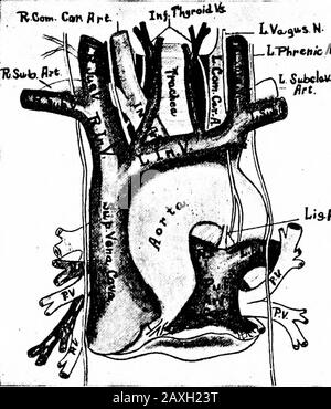 Un manuel d'anatomie . les affluents sont les veines phreniques, suprarénales, rénales, spermatiques, ovariennes, lombaire et hépatiques inférieures. (Voir Fig. 178.) Les veines phreniques inférieures (deux) renvoient une partie du sang provenant du diaphragme. Les veines suprarénales (deux) renvoient le sang de ces glandes. Les veines rénales (deux) renvoient le sang des reins. La veine rénale theright mesure environ 2,5 cm (i pouce) de longueur et la gauche est de 7,5 cm (3 pouces) de longueur. 248 LE SYSTÈME SANGUIN-VASCULAIRE les veines lombaire sont quatre paires de veines qui correspondent aux quatre paires d'artères lombaire. La spermatique ou la testicule Banque D'Images