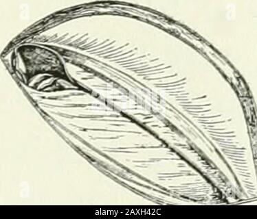 Annales de chirurgie . m/ Fig. 5—incision de la paroi postérieure du canal inguinal. LE TRAITEMENT RADICAL DE LA HERNIE INGUINALE. 617 sur le côté. Par cette manœuvre, tout état détendu existant de la partie de la fascia transversalis est corrigé. La suture est d'abord passée au-dessus du site de l'internat, et inclut le fascia transversalis, qui est drawnvers le bas et vers l'avant à cette fin. Ceci sert tocover le point où le cordon passe dans la péritonealcavité au site de l'anneau intérieur, oblitéreince ainsi, le cordon lui-même remplissant la petite ouverture dans le peri-toneum. Le positionnement Banque D'Images