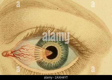 Conférences sur la chirurgie opératoire de l'œil, ou, une enquête historique et critique sur les méthodes recommandées pour le traitement de la cataracte pour la formation d'un élève artificiel, &c&c: contenant une nouvelle méthode d'exploitation de la cataracte par extraction, qui élimine toutes les difficultés jusqu'à présent de cette opération : étant la substance de cette partie du cours de l'auteur des conférences sur les principes et la pratique de la chirurgie qui se rapporte aux opérations sur cet organe . Banque D'Images