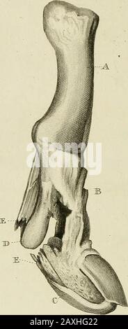 Un traité sur les dislocations et sur les fractures des articulations . Banque D'Images