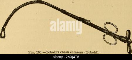 Maladies de la gorge et des passages nasaux; un guide pour le diagnostic et le traitement des affections du pharynx, du sophage, de la trachée, du larynx et des nares . ome, et quelques difficile a été expérimenté dans le désengagement de la croissance, le besoin d'être enlevé de l'instrument à cette fin. La Thégrowth a été retirée par la suite avec des pinces incurvées. Theseinstruments, bien que appelés ecraseurs, n'agissent pas sur le principe de l'écrasement de cet instrument, mais couper à travers la tumeur.Dr. Mackenzie a conçu un écraseur de fil, resserré par un cliquet de lactosérum (Fig. 165), et avec lequel il a réussi à se rétablir Banque D'Images