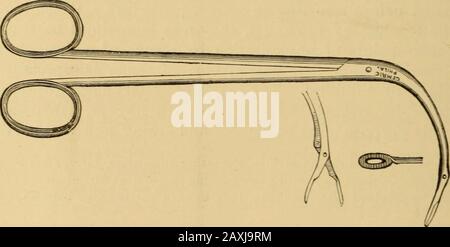 Maladies de la gorge et des voies nasales; un guide pour le diagnostic et le traitement des affections du pharynx, des sophages, de la trachée, du larynx et des nares . Fig. 143.—pinces Fain-els uniquement (Fig. 144), et donc ne pas couper une vue d'eux-mêmes dans le laryngoscopicmiroir. Ils sont très efficaces et assez forts. Ajout d'une capture à. Fig. 144.—Cuzcos forceps. Les poignées les rendent plus sécurisées. Des instruments séparés peuvent être constructedavec l'ouverture de la mâchoire mobile vers l'avant, vers l'arrière ou de chaque côté, dans l'ordre Banque D'Images