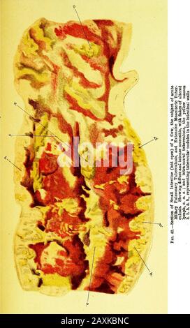 Un guide pratique pour l'inspection de la viande . Fio. 46.—valvule Ileo-coecal de Young Pig, montrant plusieurs follicules bouchés, A, (1, a., et un ulcère superficiel discret à la base, 6. 1. Un bouchon détaché. Banque D'Images