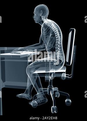 Rendu 3d illustration d'un homme travaillant sur pc - mauvaise position d'assise Banque D'Images