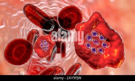 Plasmodium ovale à l'intérieur de la cellule de sang rouge, illustration Banque D'Images