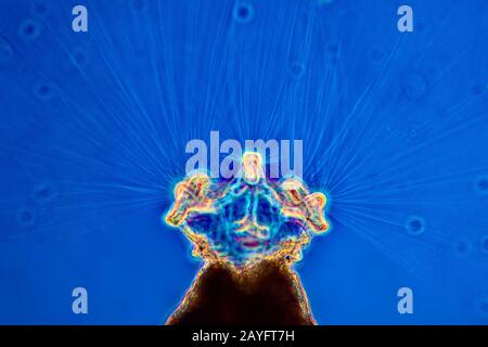 Colllotheca rotifer (Collotheca spec.), interphako Picture, x 200, Allemagne Banque D'Images