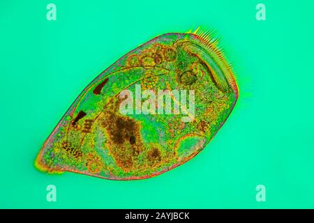 Trompette animalcule (Stentor spec.), Ciliata, photo avec microscope léger dans interphako, Allemagne Banque D'Images