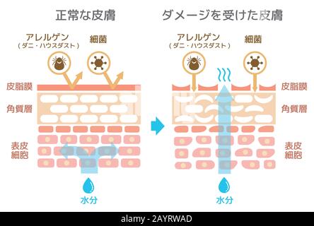 Vue en coupe de l'illustration skin.Comparison de l'effet de protection entre la peau saine et la peau blessée (japonais) Illustration de Vecteur