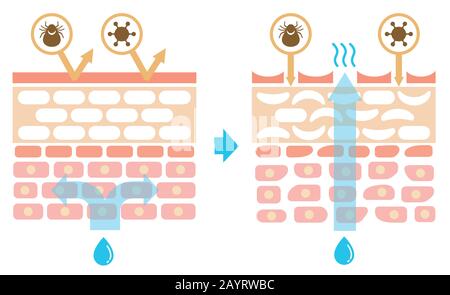 Vue en coupe de la skin.Comparison illustration de l'effet de protection entre la peau saine et la peau blessée (pas de texte) Illustration de Vecteur