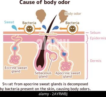 Cause de l'odeur corporelle vecteur illustration plate Illustration de Vecteur