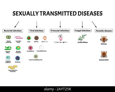 VIH, herpès, papillome, hépatite, cytomégalovirus, Zika. Définir les infections virales. Syphilis, Gonocoque, Chlamydiose, Chlamydia, Mycoplasma, Ureaplasma Illustration de Vecteur