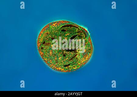 Trompette animalcule (Stentor spec.), Ciliata, photo avec microscope léger dans interphako, Allemagne Banque D'Images