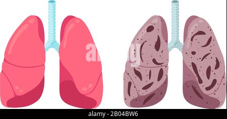 Les poumons sains et malsains comparent concept. Organe interne du système respiratoire humain fort et inflammation de la pneumonie. Illustration d'un vecteur anatomique pour la respiration médicale Illustration de Vecteur