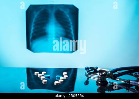 Concept de traitement de la tuberculose. X-ray des poumons, avec la pathologie, phonendoscope avec pilules sur la table. La maladie pulmonaire. La pneumonie. Medical flatley, p Banque D'Images