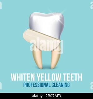 Concept vectoriel de technicien dentaire blanchiment de placage dentaire. Illustration de la stomatologie de la santé et du nettoyage des dents professionnelles Illustration de Vecteur