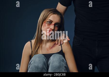 Un homme fort a mis sa main sur l'épaule féminine. Victime effrayée avec des ecchymoses sur le visage assis à proximité. Fond bleu. Violence familiale, abus. Gros plan. Banque D'Images