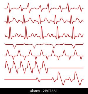 Cardiogrammes vectoriels en ligne ou électrocardiogramme sur le moniteur, symboles médicaux des battements de cœur. Cœur d'impulsion du cardiogramme, illustration des battements cardiaques de l'impulsion du diagramme Illustration de Vecteur