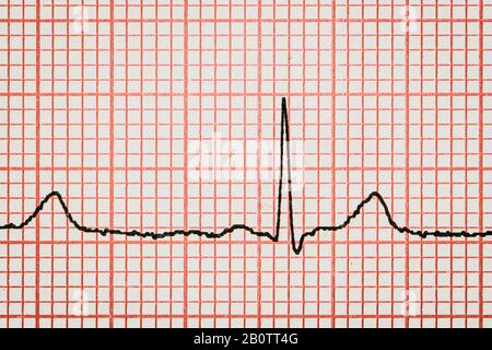 ligne réelle d'un cardiogramme électrotechnique Banque D'Images