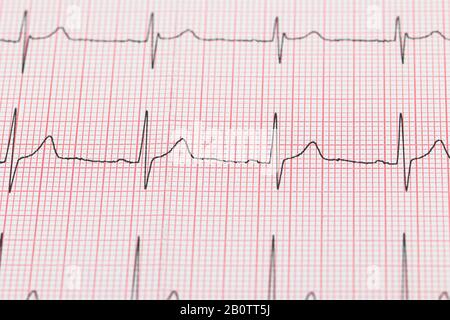 ligne réelle d'un cardiogramme électrotechnique Banque D'Images