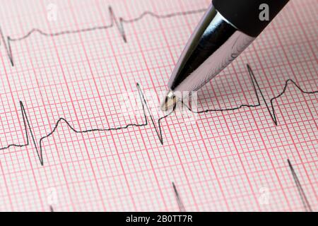 ligne réelle d'un cardiogramme électrotechnique Banque D'Images