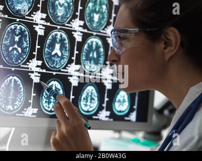 Diagnostic de neurologie, examen du cerveau humain sur un écran analysé par un médecin féminin dans une clinique de neurologie. Banque D'Images