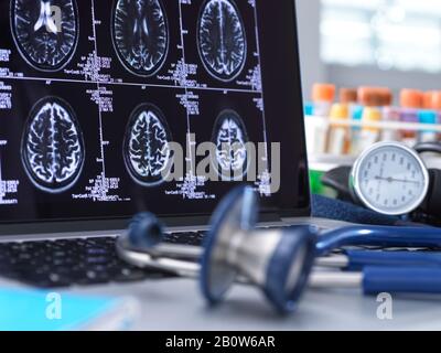 Gros plan du stéthoscope et de l'acquisition cérébrale sur un écran d'ordinateur. Banque D'Images