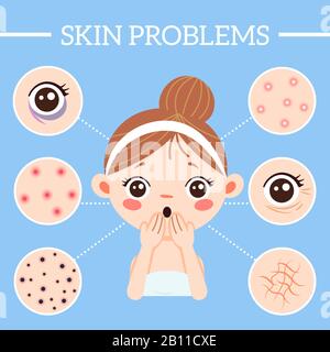 Infographie sur les problèmes de peau. Vieillit les problèmes de rides, les blackheads et les pores obstrués. Acné sur l'illustration vectorielle de peau de femme Illustration de Vecteur