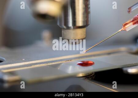 Test sanguin pour la science du coronavirus et les tests de santé pour la transmission de la grippe. Gros plan de l'échantillon sanguin sur la lame du microscope. COVID-19 maladie e Banque D'Images