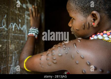 Fille avec scarification des tribus du nord du Bénin, Afrique Banque D'Images