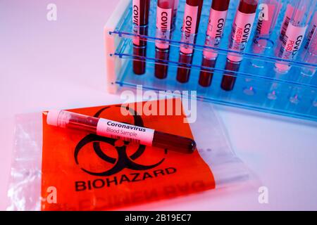 Échantillon sanguin pour le Coronavirus qui se propage rapidement et qui est originaire de Wuhan. Tube d'essai sur un formulaire de demande d'essai vide pour covid-19, transport de déchets biologiques Banque D'Images