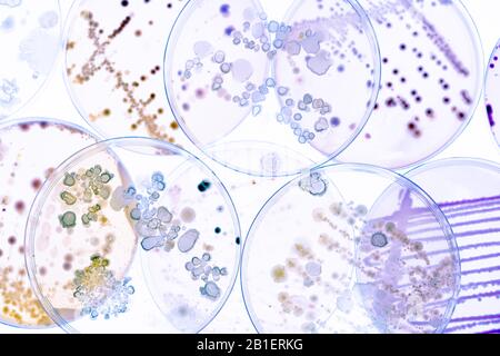 Mélange de colonies de bactéries et de champignons dans divers boîtes de Petri Banque D'Images