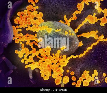 COVID-19. Roman Coronavirus SARS-CoV-2 Cette image au microscope électronique à balayage montre le SARS-CoV-2 (objets dorés ronds) émergeant de la surface des cellules cultivées en laboratoire. Le SRAS-COV-2, également appelé 2019-nCoV, est le virus qui cause COVID-19. Le virus montré a été isolé d'un patient aux États-Unis Credit: NIAID-RML Banque D'Images