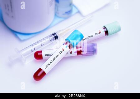 Test sanguin positif dans le tube à vide pour la nouvelle analyse biochimique du Coronavirus COVID-19 à propagation rapide. Concept de coronavirus. Banque D'Images