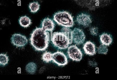 Micrographe électronique de transmission de COVID-19, nouveau coronavirus, particules de virus, isolé d'un patient capturé et amélioré en couleur à l'installation de recherche intégrée NIAID le 14 février 2020 à fort Detrick, Maryland. Banque D'Images