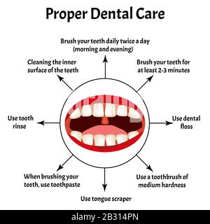 Soins dentaires appropriés. Journée Internationale Des Dentistes. La structure des dents et de la cavité buccale. Maladies des dents. Infographies. Illustration vectorielle activée Illustration de Vecteur