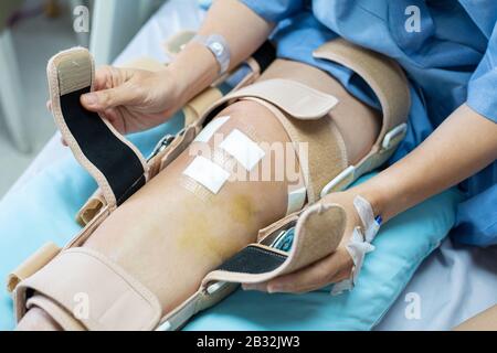 Main de la femme asiatique assise sur le lit à l'hôpital essayer de porter le soutien de genouillère après une chirurgie postérieure du ligament cruciat.soins de santé et médical Banque D'Images