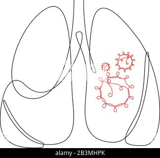 Une lignée continue de Coronavirus COVID-19 dans Les Symptômes pulmonaires de la maladie. Illustration vectorielle Illustration de Vecteur