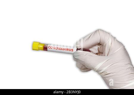 COVID-19 concept mondial d'éclosion avec étiquette de coronavirus sur vacutainer. Le pharmacien avec des gants de protection blancs affiche un tube sanguin avec un échantillon de virus Wuhan. Banque D'Images