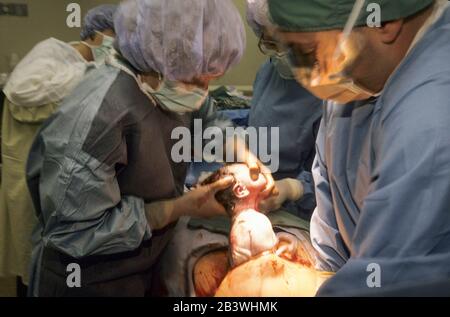 Austin, Texas USA, 1994: Obstétricien effectue la césarienne d'un bébé masculin.M. ©Bob Daemmrich Banque D'Images