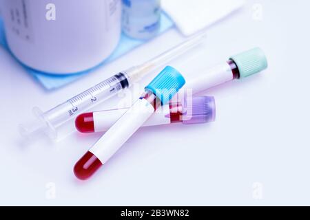 Coronavirus COVID-19 test sanguin dans le tube vacum avec des étiquettes vides autocollants pour votre texte d'analyse biochimique. Image conceptuelle. Banque D'Images