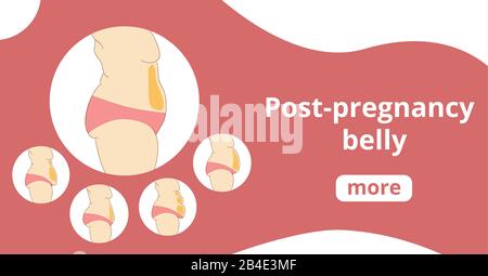 Types de bannière tummies femelles Illustration de Vecteur