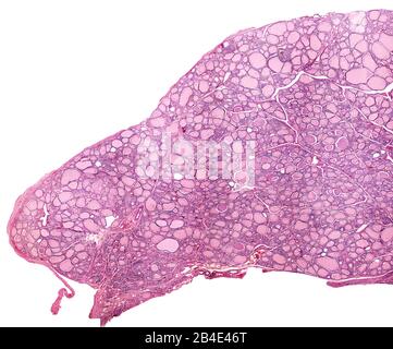 Micrographe à faible grossissement montrant une thyroïde humaine. Le parenchyme thyroïde est composé de beaucoup de follicules remplis de colloïde. Microg. Microscope léger Banque D'Images