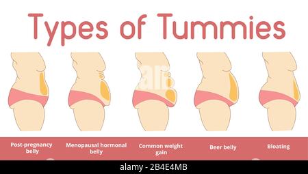 Types de bannière tummies femelles Illustration de Vecteur